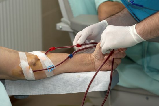 HEMODIALISE POR FISTULA ARTERIOVENOSA - Dependentes de hemodiálise conseguem tratamento gratuito pelo Instituto do Rim