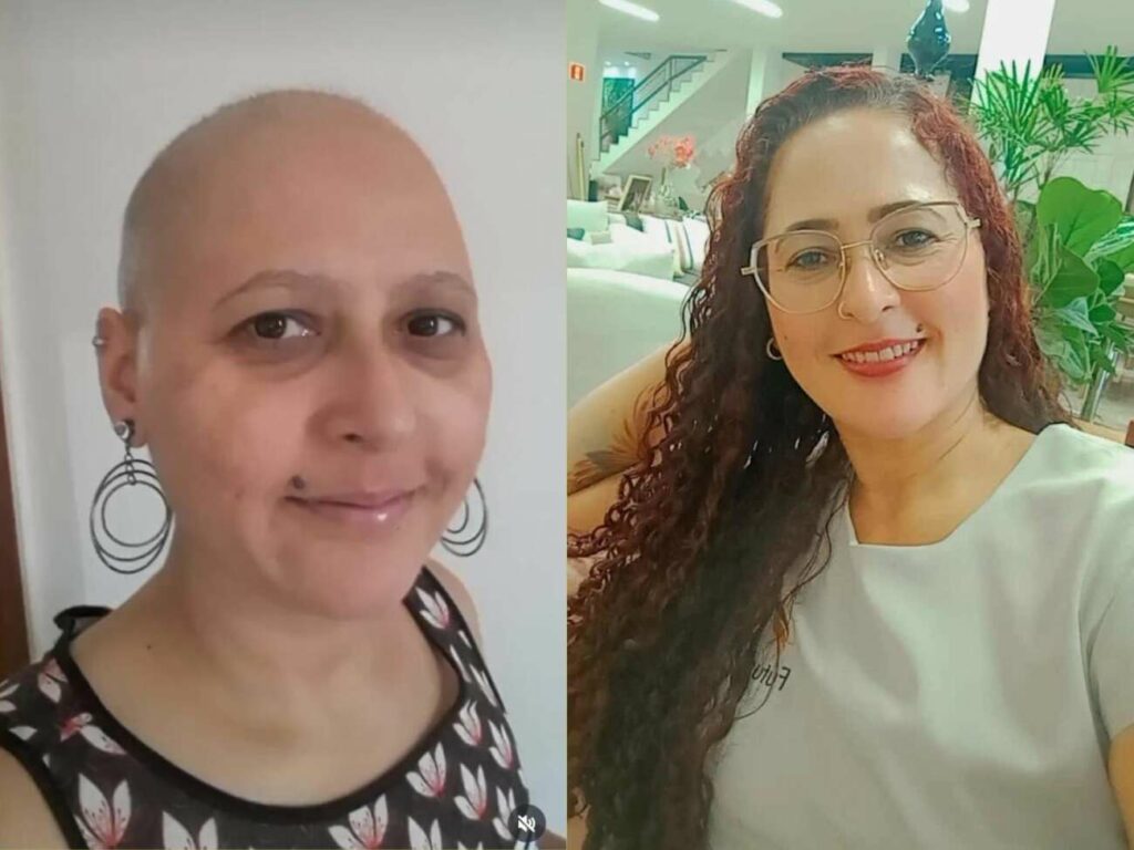 Adriana Almeida antes e depois - Esteticista de Guarapari cria projeto para melhorar autoestima de mulheres após tratamento contra câncer de mama